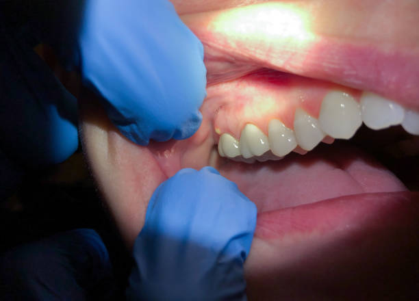 Best Emergency Cosmetic Dentistry in Berkeley Lake, GA